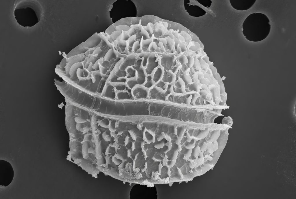 Dinoflagellate algae under the scanning electron microscope.